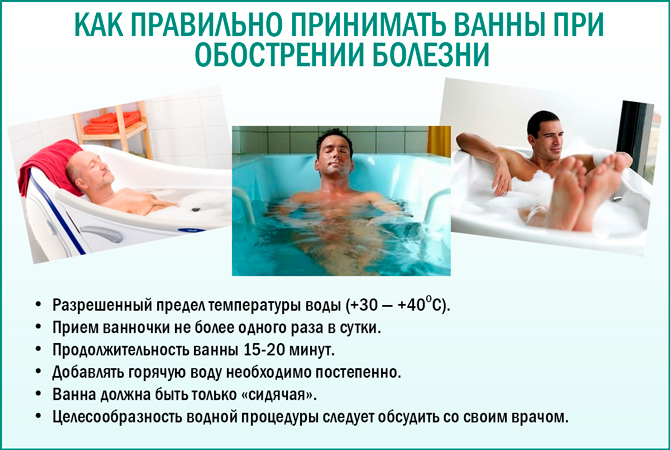 Ванна: какую лучше выбрать, отзывы специалистов о материале
